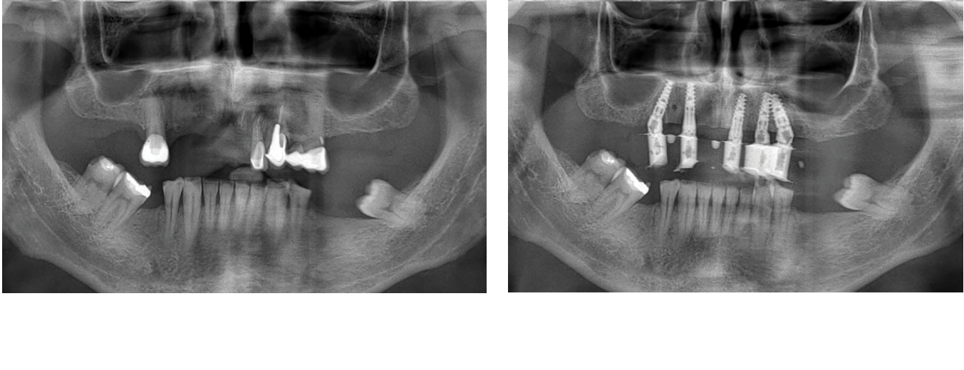 Dr. William Jackomis | ​Full Arch Course