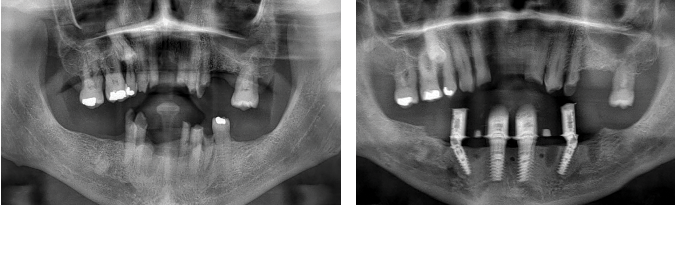 Dr. Mohamed Shariff | ​Full Arch Course